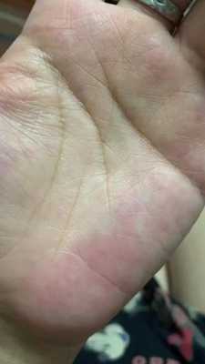 孕期的脉搏(怀孕左手脉搏跳动明显) 第1张 孕期的脉搏(怀孕左手脉搏跳动明显) 第1张