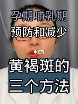 如何预防孕期长斑（如何预防孕期长斑的方法）  第1张