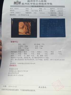 三维彩超结果怎么看,胎儿三维彩超图片好丑 第2张 三维彩超结果怎么看,胎儿三维彩超图片好丑 第2张