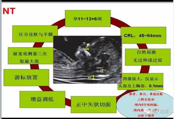 怎样让胎儿动起来(做nt怎样让胎儿动起来) 第1张 怎样让胎儿动起来(做nt怎样让胎儿动起来) 第1张