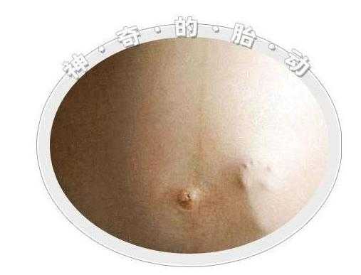 怀孕6个月胎儿胎动位置在哪里才正常呢,怀孕6个月的胎儿图片 真实 第2张 怀孕6个月胎儿胎动位置在哪里才正常呢,怀孕6个月的胎儿图片 真实 第2张