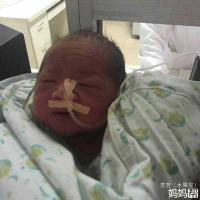 31周生下来的胎儿是有多大的?还能不能存活的,31周胎儿多重正常范围 第3张 31周生下来的胎儿是有多大的?还能不能存活的,31周胎儿多重正常范围 第3张