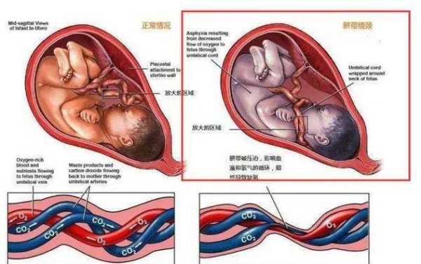 孕期脐带(孕期脐带绕颈有什么症状) 第2张 孕期脐带(孕期脐带绕颈有什么症状) 第2张