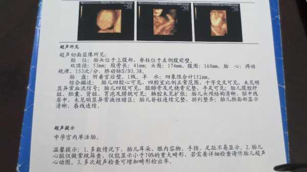 22周胎儿四维彩超(22周胎儿四维彩超图片) 第2张 22周胎儿四维彩超(22周胎儿四维彩超图片) 第2张