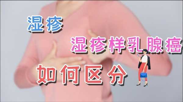 怀孕期间乳头痒怎么办(孕妇胸部瘙痒怎么治) 第2张 怀孕期间乳头痒怎么办(孕妇胸部瘙痒怎么治) 第2张