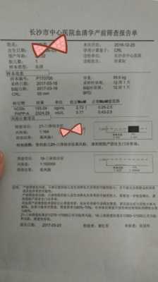 胎儿21三体综合征(胎儿21三体综合征高风险是什么意思) 第3张 胎儿21三体综合征(胎儿21三体综合征高风险是什么意思) 第3张