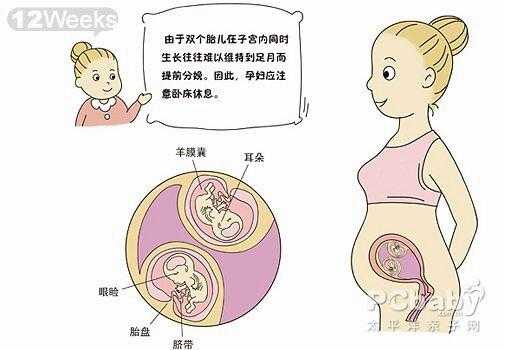 双胞胎孕期注意事项（双胞胎孕期注意事项有哪些）  第2张