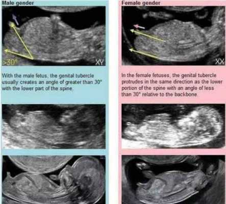 怀孕12周了孩子小怎么回事,胎儿十二周能看出男女吗 第1张 怀孕12周了孩子小怎么回事,胎儿十二周能看出男女吗 第1张