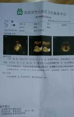 为什么b超单怀孕周数比实际小一周多呢,孕期比超单CC和CM是不一样吗 第2张 为什么b超单怀孕周数比实际小一周多呢,孕期比超单CC和CM是不一样吗 第2张