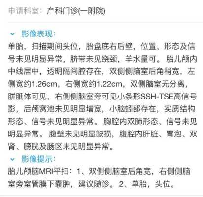 胎儿脑室增宽的原因(胎儿脑室增宽的原因该怎么解决) 第2张 胎儿脑室增宽的原因(胎儿脑室增宽的原因该怎么解决) 第2张