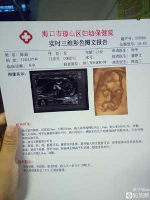 孕期nt是检查胎儿什么,NT是胎儿的什么 第2张 孕期nt是检查胎儿什么,NT是胎儿的什么 第2张