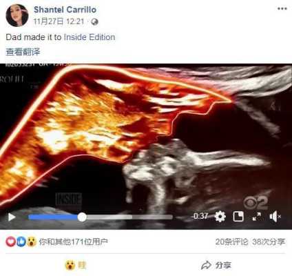 胎儿的父亲(胎儿的父亲死亡) 第1张 胎儿的父亲(胎儿的父亲死亡) 第1张