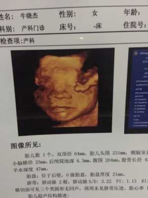 八个月胎儿彩超(八个月胎儿彩超图真实图) 第2张 八个月胎儿彩超(八个月胎儿彩超图真实图) 第2张