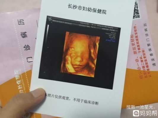 孕晚期吃什么胎儿速长?怀孕36周吃什么食物胎儿长得快,四维有这个一般是女孩 第2张 孕晚期吃什么胎儿速长?怀孕36周吃什么食物胎儿长得快,四维有这个一般是女孩 第2张