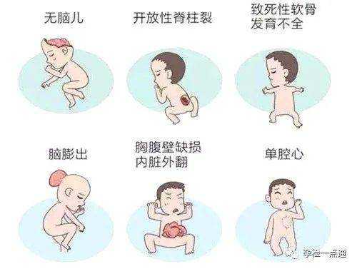 胎儿致死性畸形(胎儿致死性畸形) 第1张 胎儿致死性畸形(胎儿致死性畸形) 第1张