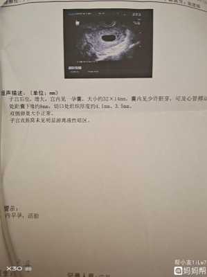 备孕期间可以做彩超吗(备孕期间可以做彩超吗女) 第2张 备孕期间可以做彩超吗(备孕期间可以做彩超吗女) 第2张