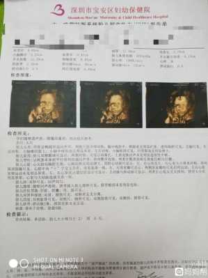 三维彩超结果怎么看,胎儿三个月彩超图片 第2张 三维彩超结果怎么看,胎儿三个月彩超图片 第2张