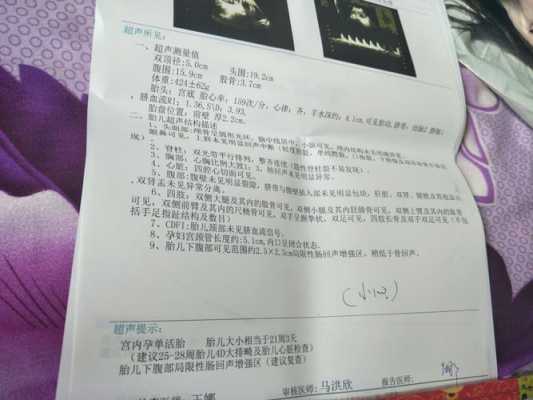 胎儿部分肠管回声增强(下腹部肠管回声增强怎么办) 第2张 胎儿部分肠管回声增强(下腹部肠管回声增强怎么办) 第2张