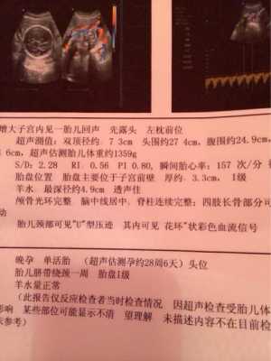 胎儿颈部可见u血流(胎儿颈部可见u血流是什么意思) 第2张 胎儿颈部可见u血流(胎儿颈部可见u血流是什么意思) 第2张