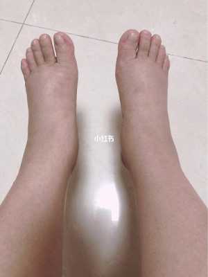 孕期脚凉怎么回事(孕期脚凉是什么原因怎么办) 第1张 孕期脚凉怎么回事(孕期脚凉是什么原因怎么办) 第1张