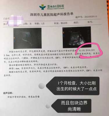 胎儿有瘤(产科医生婴儿肿瘤第几集) 第2张 胎儿有瘤(产科医生婴儿肿瘤第几集) 第2张