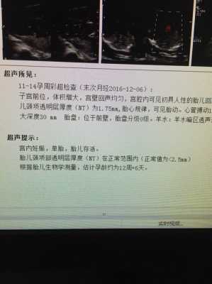 超声胎儿诊断(超声胎儿诊断怎么写) 第2张 超声胎儿诊断(超声胎儿诊断怎么写) 第2张