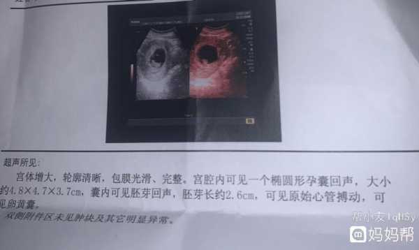 孕9周如何判断胎儿正常,要做什么检查,怎么判断胎儿是否正常发育 第2张 孕9周如何判断胎儿正常,要做什么检查,怎么判断胎儿是否正常发育 第2张