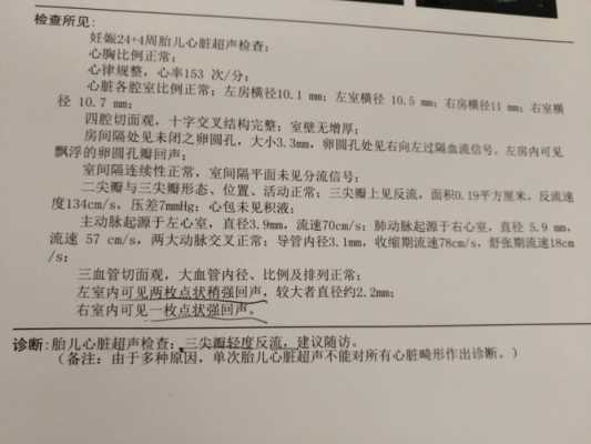 胎儿25周四维彩超显示三尖瓣少量反流,其它正常,25周胎儿四维彩超图 第3张 胎儿25周四维彩超显示三尖瓣少量反流,其它正常,25周胎儿四维彩超图 第3张