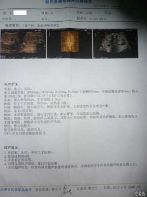 胎儿双肾实质回声增强(胎儿双肾实质回声增强) 第2张 胎儿双肾实质回声增强(胎儿双肾实质回声增强) 第2张