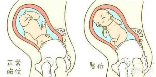 胎儿打嗝是什么样的（胎儿打嗝是什么样的感觉）  第2张