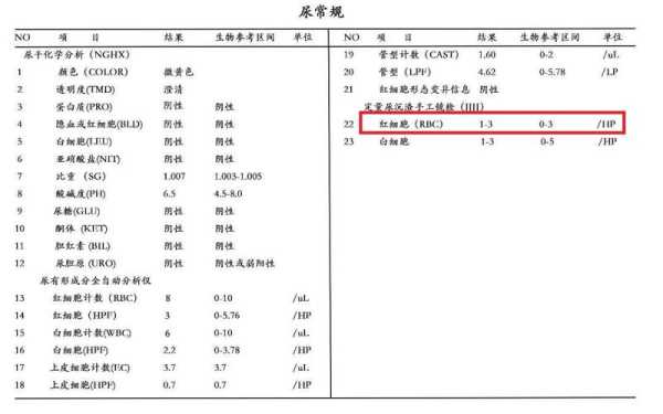 孕妇尿检红细胞偏高怎么回事,孕期尿红细胞高是什么原因 第2张 孕妇尿检红细胞偏高怎么回事,孕期尿红细胞高是什么原因 第2张