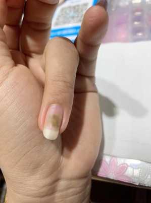 灰指甲用药会影响怀孕吗,备孕期能做指甲吗贴甲片  第1张