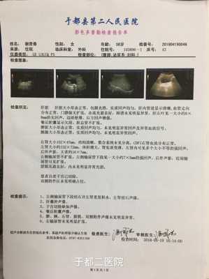 少一个肾算几级残疾,胎儿肾缺失的原因分析 第2张 少一个肾算几级残疾,胎儿肾缺失的原因分析 第2张