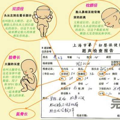 怎么看胎儿b超图(怎么看胎儿b超图像) 第1张 怎么看胎儿b超图(怎么看胎儿b超图像) 第1张