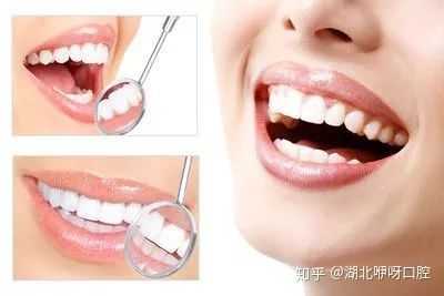 备孕期能洗牙吗（备孕期能洗牙吗有影响吗）  第2张