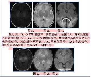 做核磁共振会影响孩子的大脑神经系统发育吗,胎儿发育神经是几周 第1张 做核磁共振会影响孩子的大脑神经系统发育吗,胎儿发育神经是几周 第1张