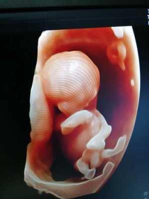怀孕12周胎儿(怀孕12周了孩子小怎么回事) 第1张 怀孕12周胎儿(怀孕12周了孩子小怎么回事) 第1张