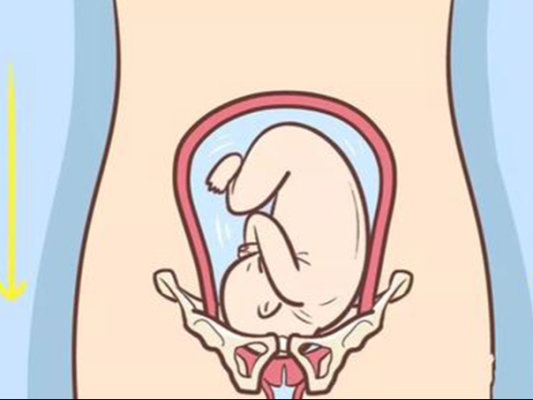 孕期孩子头大是什么原因,胎儿头高能顺产吗  第2张