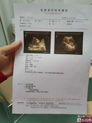 胎儿十二周发育图（12周胎心170正常吗）  第2张
