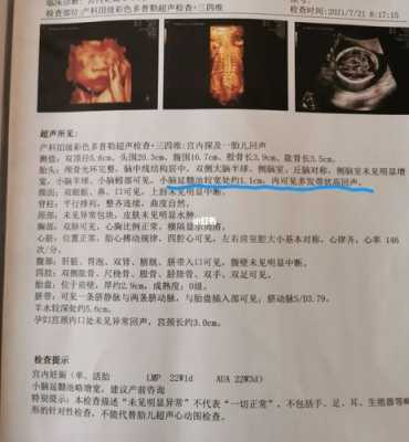 孕23周胎儿小脑横径宽该怎办啊呢?一般出生之后会不会有什么,胎儿小脑宽是怎么回事 第2张 孕23周胎儿小脑横径宽该怎办啊呢?一般出生之后会不会有什么,胎儿小脑宽是怎么回事 第2张