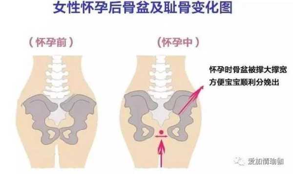 孕期盆骨疼（孕期盆骨疼在哪个部位?）  第2张