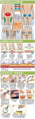 孕期打胰岛素要打多久(孕期打胰岛素要打多久一次) 第2张 孕期打胰岛素要打多久(孕期打胰岛素要打多久一次) 第2张
