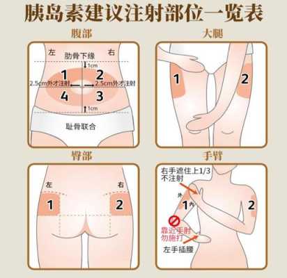 孕期打胰岛素要打多久(孕期打胰岛素要打多久一次) 第1张 孕期打胰岛素要打多久(孕期打胰岛素要打多久一次) 第1张