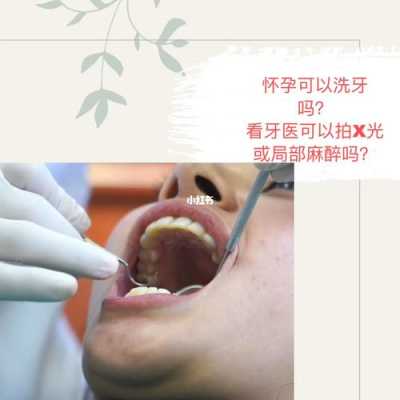 备孕期间可以洗牙吗,怀孕期间可以洗牙吗有影响吗  第1张