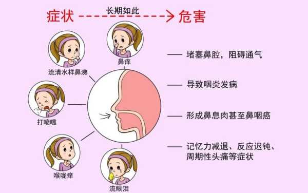 孕期有过敏性鼻炎,鼻炎影响胎儿发育吗 第1张 孕期有过敏性鼻炎,鼻炎影响胎儿发育吗 第1张