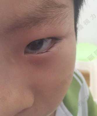 婴儿睫毛多长算是长,胎儿长短腿产检可以检查出吗 第3张 婴儿睫毛多长算是长,胎儿长短腿产检可以检查出吗 第3张