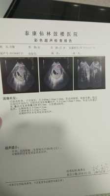 怀孕有9周了，产检结果见微弱原始心管搏动，这是什么意思,胎儿先心病是什么原因引起的  第1张