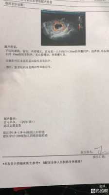 怀孕有9周了，产检结果见微弱原始心管搏动，这是什么意思,胎儿先心病是什么原因引起的  第2张
