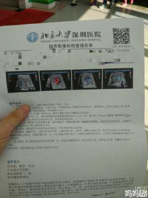 胎儿胆囊偏小怎么办(提示胎儿胆囊显示不清,这说明什么情况) 第2张 胎儿胆囊偏小怎么办(提示胎儿胆囊显示不清,这说明什么情况) 第2张
