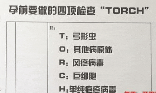 孕期查弓形虫(孕期查弓形虫多少钱) 第1张 孕期查弓形虫(孕期查弓形虫多少钱) 第1张